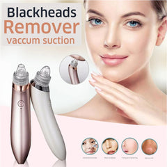 Derma Suction Blackhead Remover – 5-in-1 Rechargeable Acne Vacuum